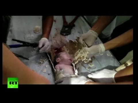 VIDEO: Šokējoši kadri! Ķīnā jaundzimušu zīdaini noskalo podā! (Dramatic Rescue: Newborn baby pulled from sewage pipes in China)