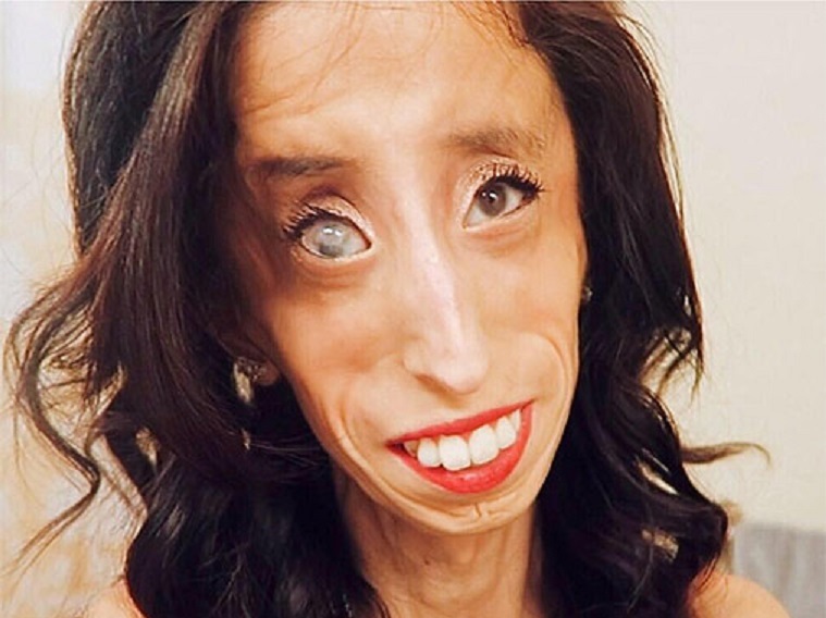 VIDEO: Visu cieņu! Šī sieviete ir pārdzīvojusi elli zemes virsū! (Lizzie Velasquez: I Choose To Be Happy!)