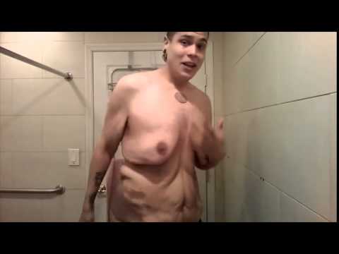 VIDEO: Kas notika ar puisi, kurš notievēja par 122 kg!? (Matt Diaz Losing Weight Skin Excess Speech #1)