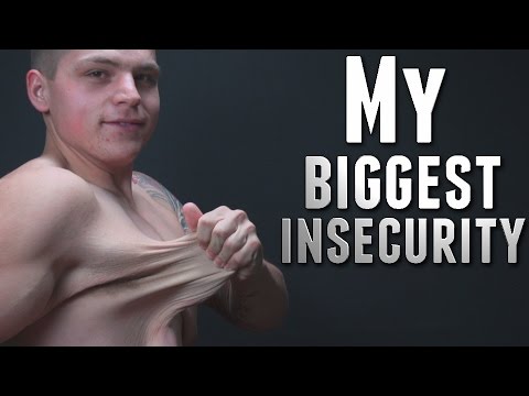 VIDEO: Viņš sapņoja par ideālo ķermeni! (My Biggest Insecurity: Loose Skin)