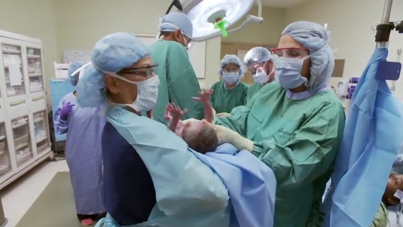 Vecāki gaidīja “normālus” dvīņus, bet, kad ārsti parādīja tikko dzimušo bērnu foto, viņai aizrāvās elpa..
