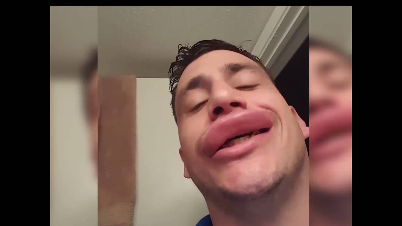 VIDEO: Gribas lielas un pilnīgas lūpas, nemaksājot ne centa.. Bet, lūdzu!