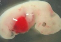 Zinātnieki injicē cilvēka šūnas cūkas embrijā, lai izveidotu pirmo cilvēka – cūkas hibrīdu