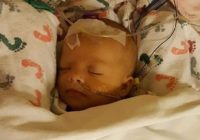 Mazulim nepieciešama aknu transplantācija vai arī viņas iekšas iznīcinās viņas pašas žults